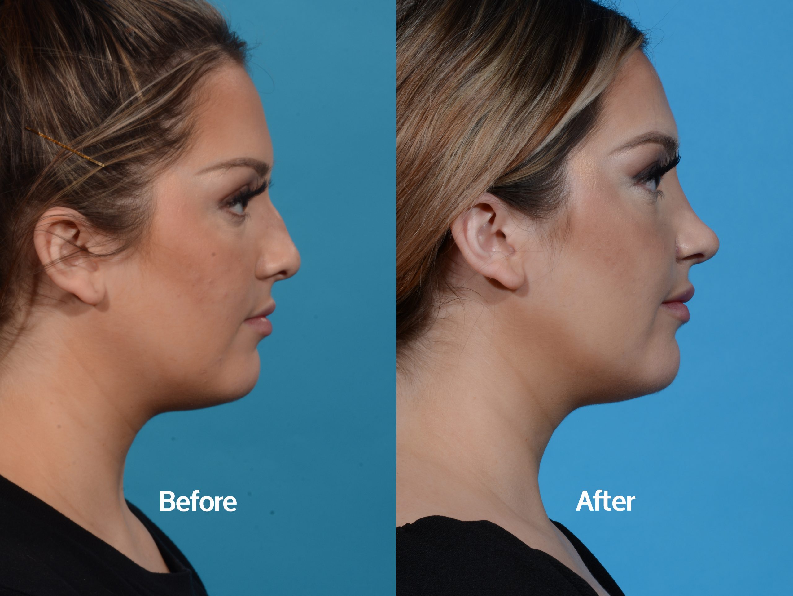 Before & After