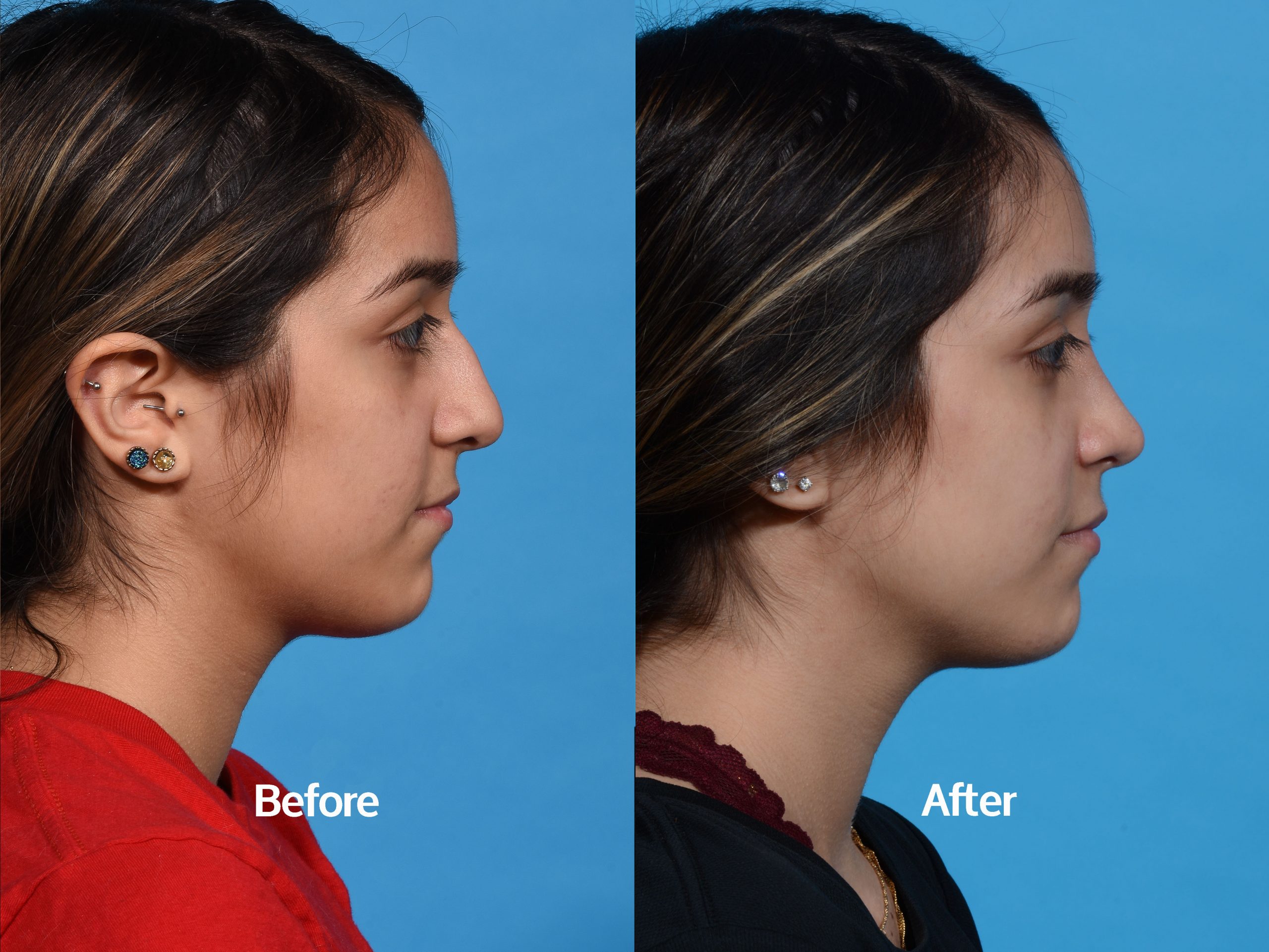 Before & After