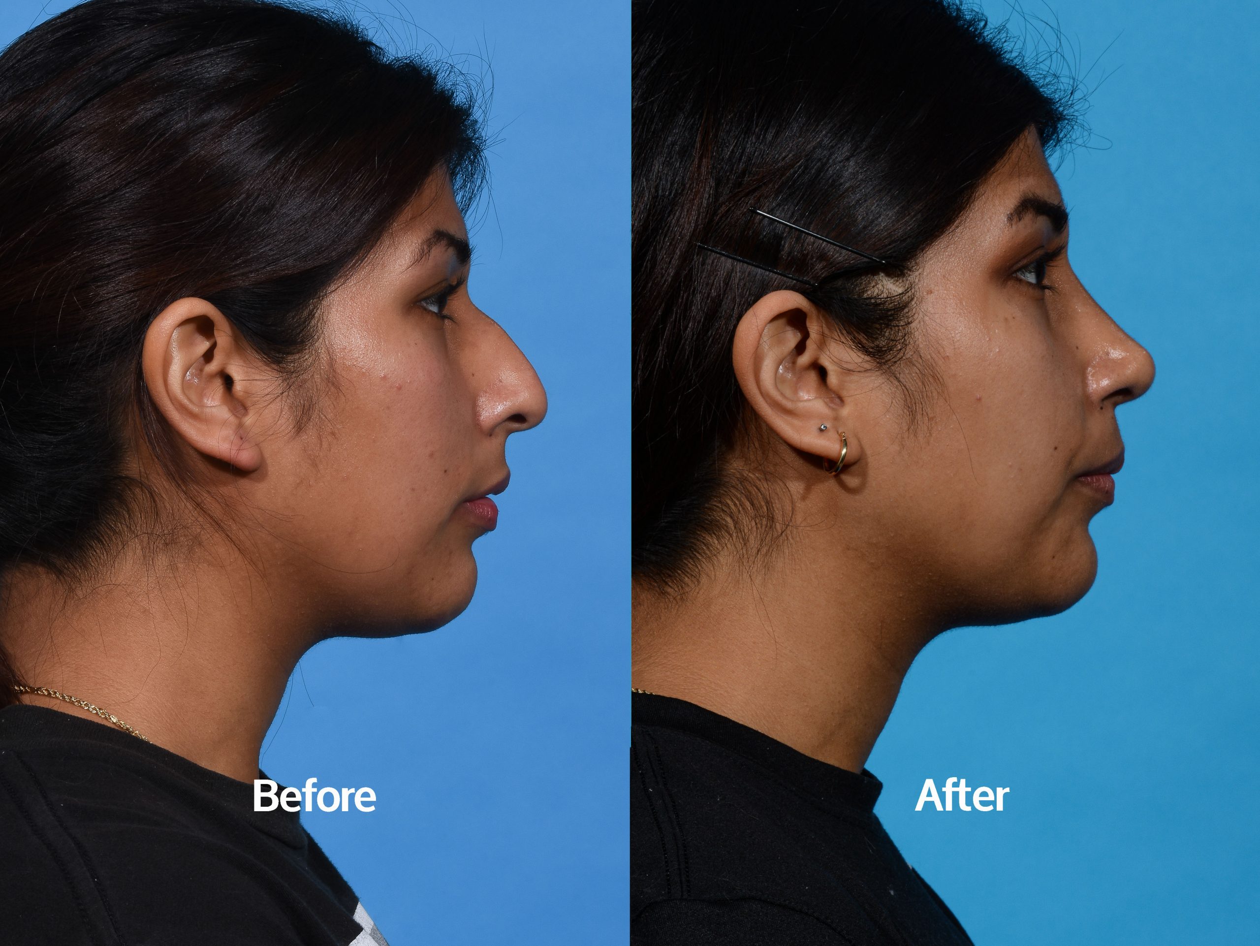Before & After