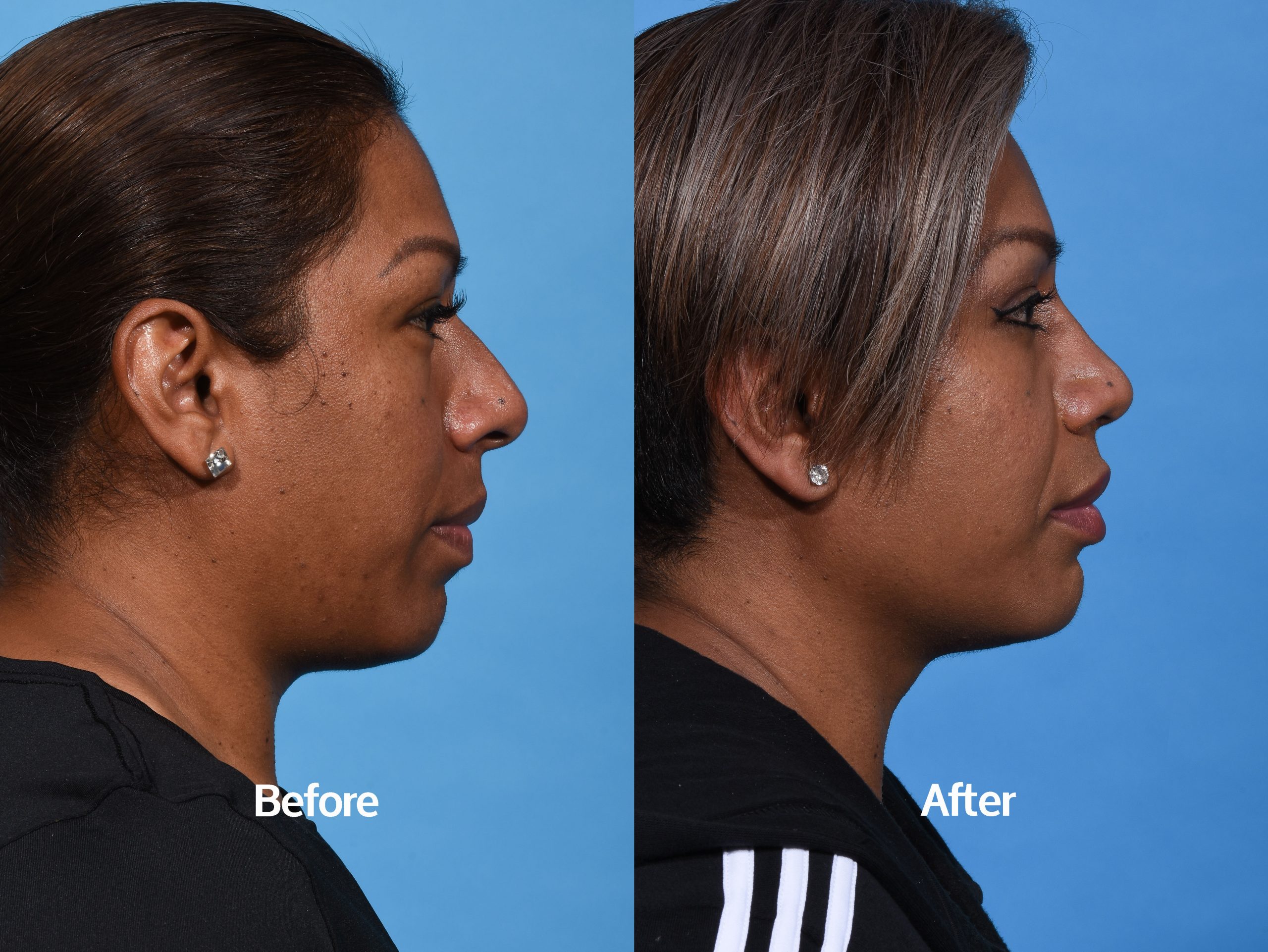 Before & After