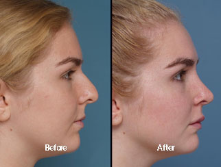 Before & After