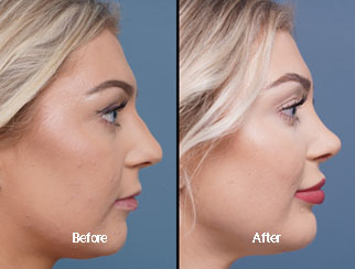 Before & After