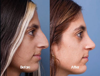 Before & After